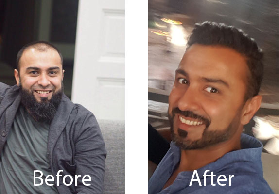 hair transplant clinic