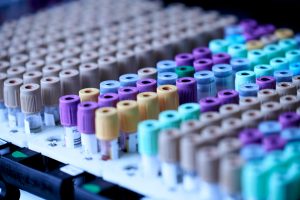 PCR Molecular Test 