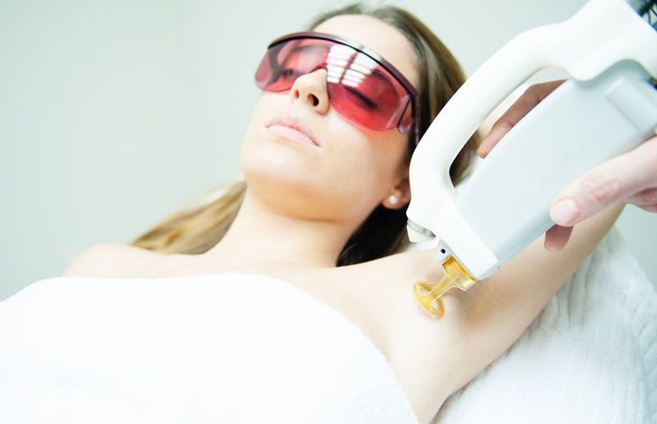 Laser Hair Removal