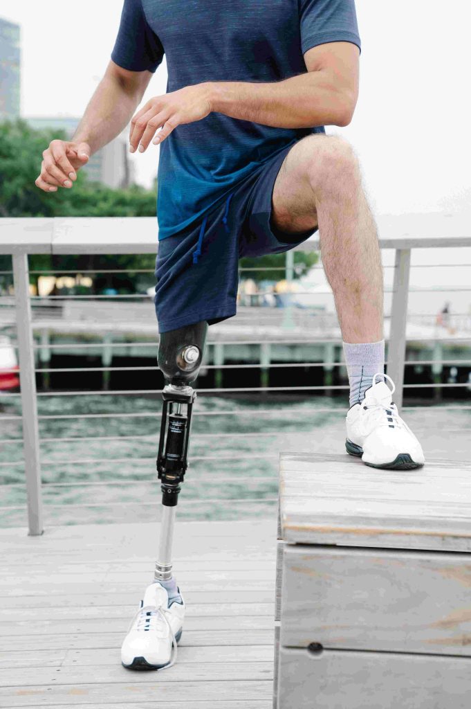 limb lengthening surgery in India