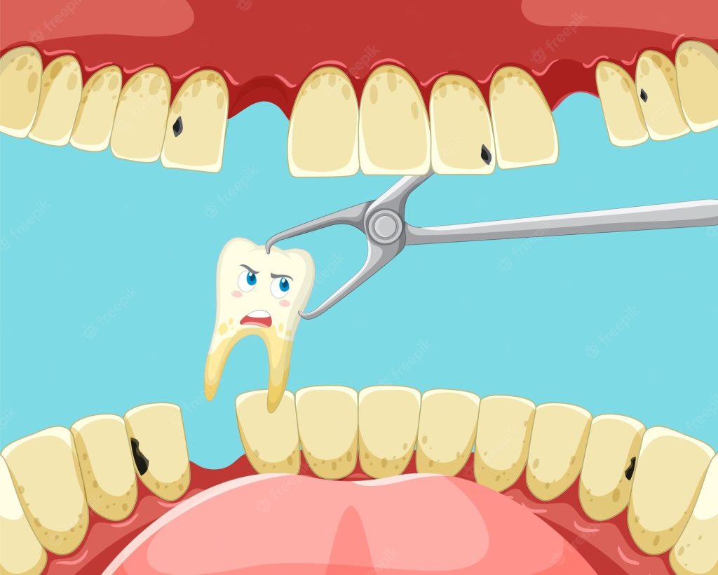tooth extractions and dentures