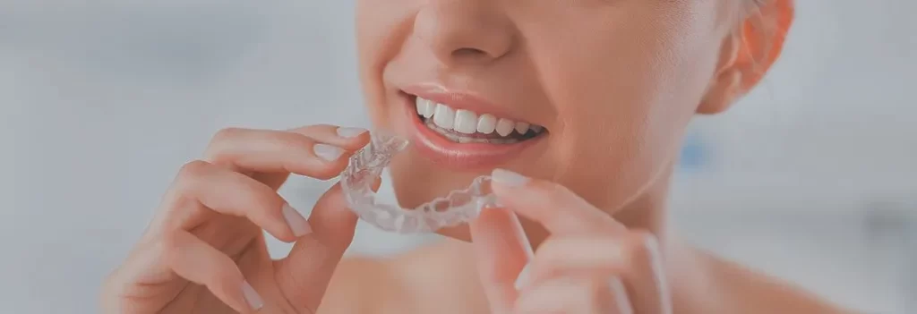 invisalign Surrey