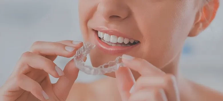 invisalign Surrey