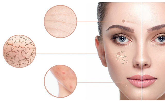 Hydrate Your Skin in Ways It’s Never Been Hydrated Before