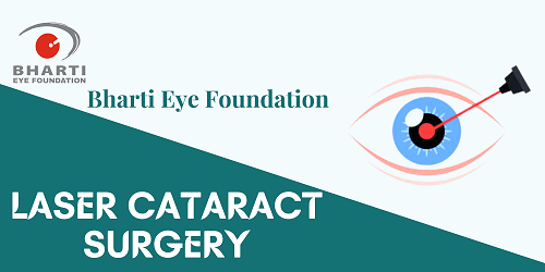 Laser cataract surgery - featured image