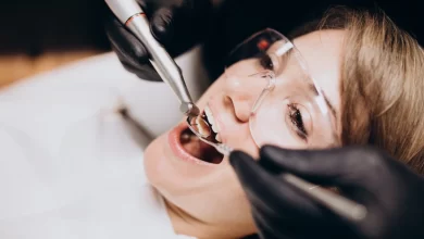 cosmetic dentist in gurugram(gurgaon)