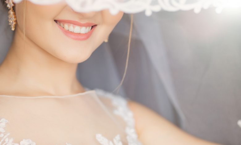 Teeth Whitening for Wedding Day